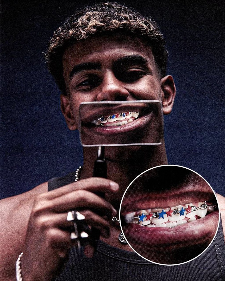 ارتودنسی های لامین یامال