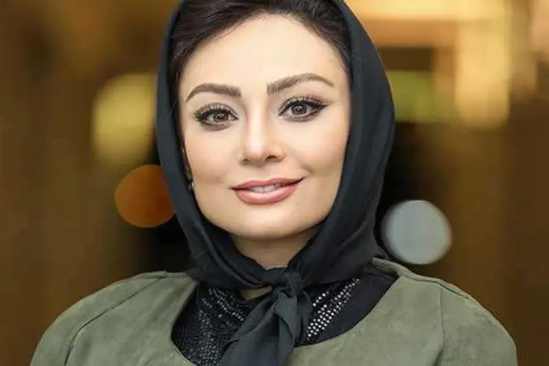 عکس یکتا ناصر بعد از عمل بینی 